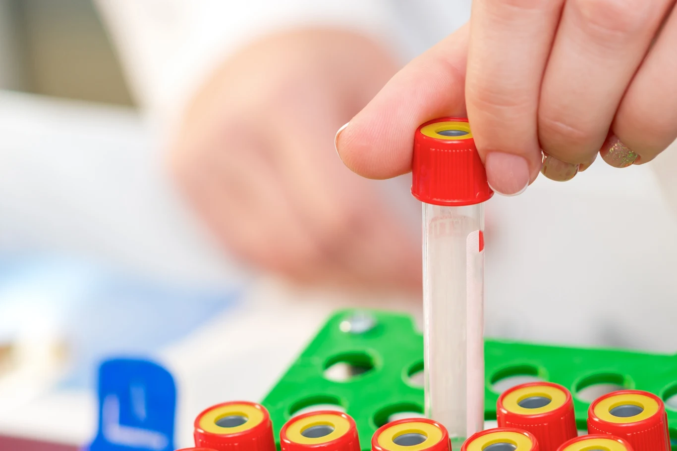 Osoby z grupą krwi AB częściej zapadają na choroby otępienne, metaboliczne oraz choroby układu krążenia