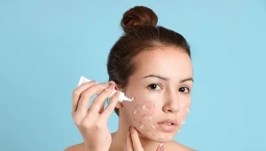 Przebarwienia na twarzy można skutecznie zredukować przy użyciu odpowiednich metod pielęgnacyjnych