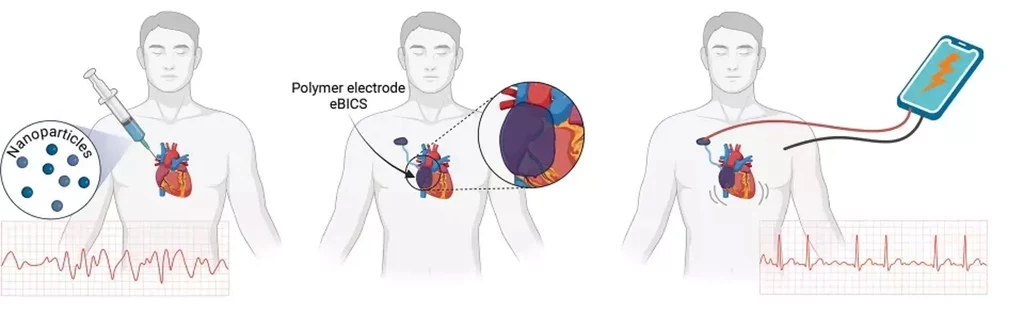 Diagram ilustrujący, jak działa nowy wstrzykiwany rozrusznik serca