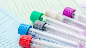 Poznaj sześć badań kluczowych w diagnostyce tarczycy