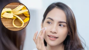 Nie wyrzucaj skórek z banana. Wykorzystasz je w codziennej pielęgnacji 