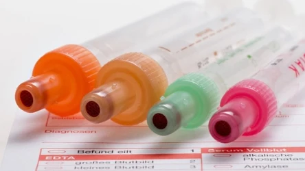 Dokładna ocena krzepnięcia krwi ma ogromne znaczenie w wielu sytuacjach. Wymagana jest przed operacjami, przy podejrzeniu krwawień lub w zakrzepicy