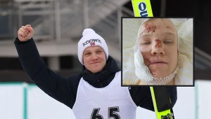 Sondre Ringen po triumfie w zawodach Pucharu Kontynentalnego w Sapporo. W ramce zdjęcie ze szpitala po upadku w Engelbergu