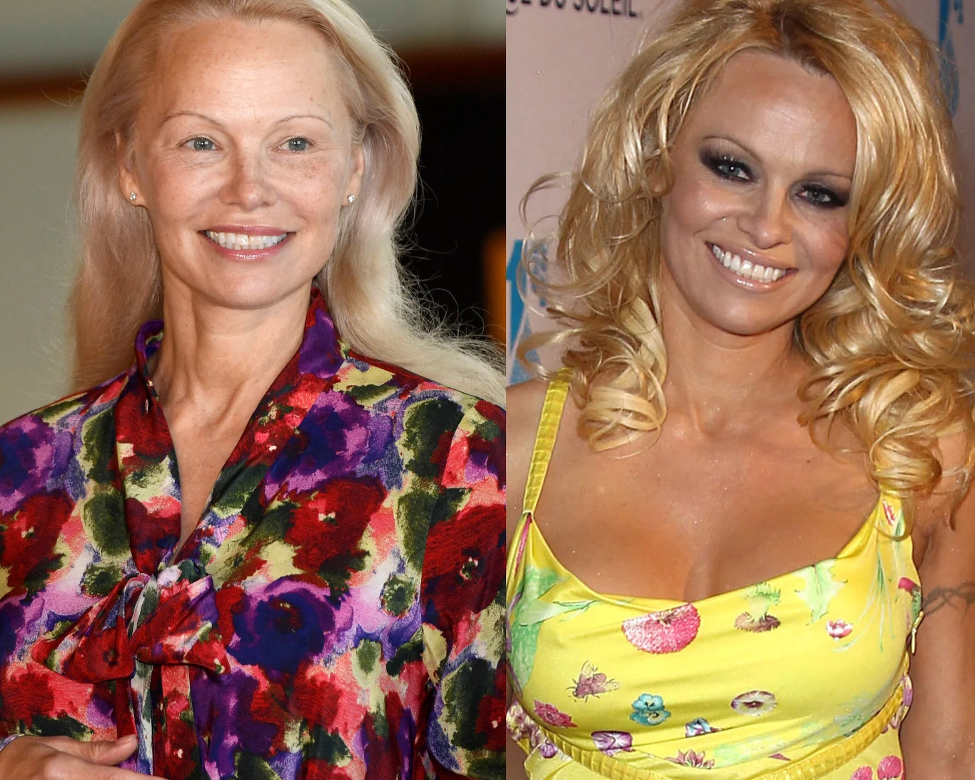 Pamela Anderson jest dzisiaj nie do poznania. To dlatego zmieniła wizerunek Pamela Anderson jest dzisiaj nie do poznania. To dlatego zmieniła wizerunek