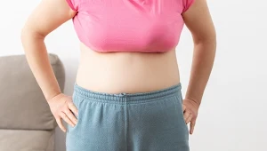 PCOS często wiąże się z przybieraniem na wadze, nadmiernym owłosieniem, uciążliwym trądzikiem i nie tylko