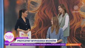 Najlepszy sposób na wypadanie włosów? Trycholożka nie ma wątpliwości