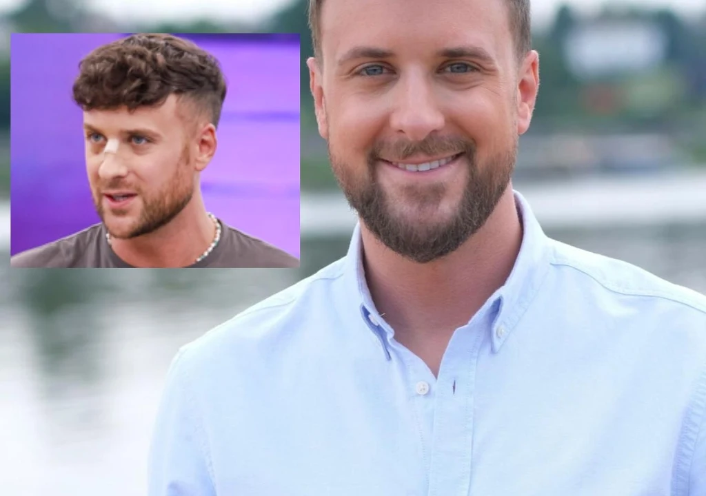 Aleksander Sikora pojawił się w telewizji z opatrunkiem na twarzy.