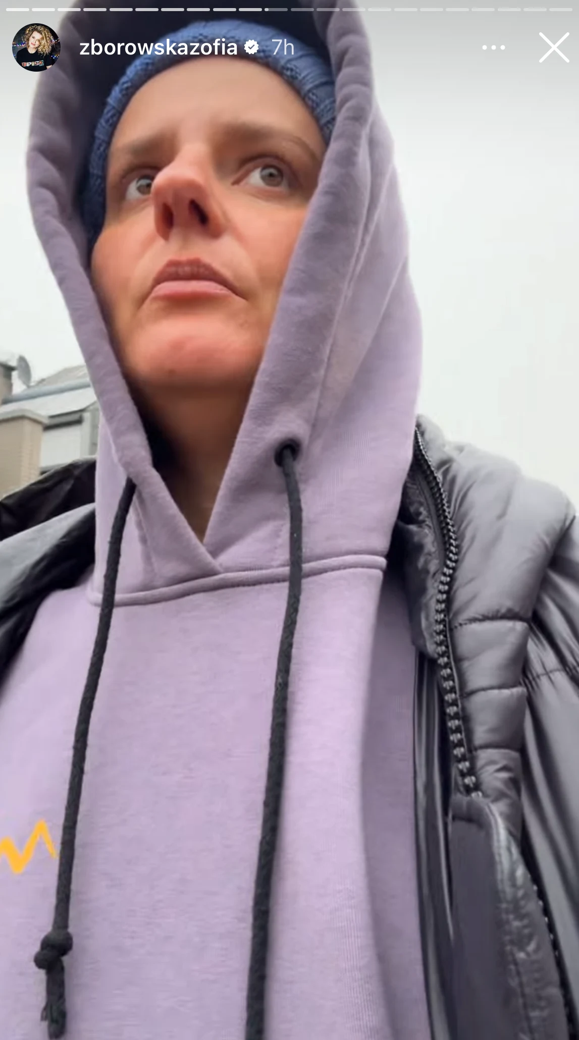 Zofia Zborowska opowiedziała o problemach zdrowotnych Krysi