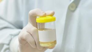 Test GALEAS Bladder wykrywa raka pęcherza z 92-procentową skutecznością