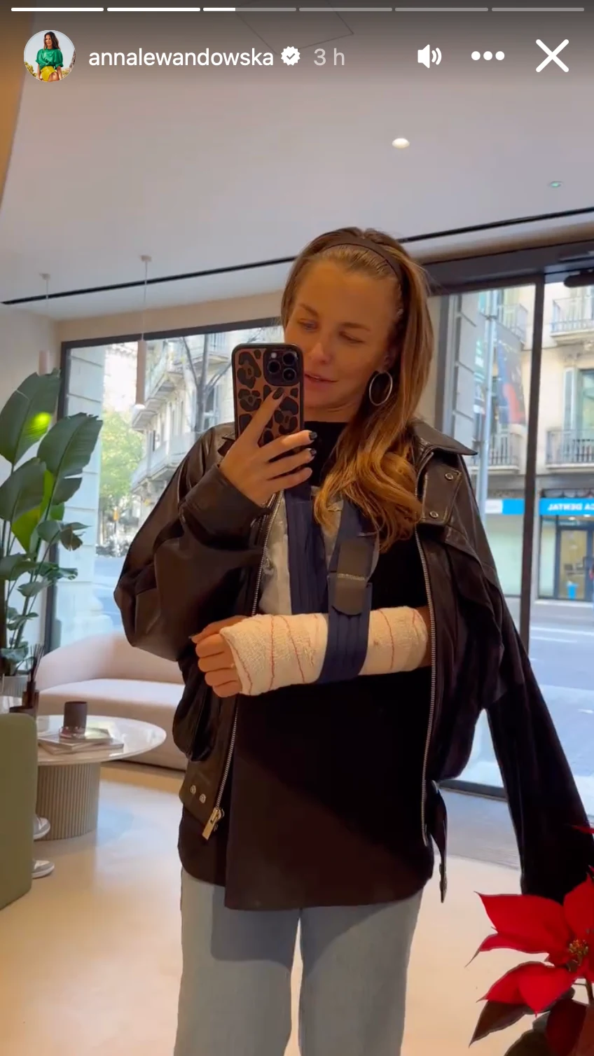 Anna Lewandowska na swojej siłowni tuż po operacji