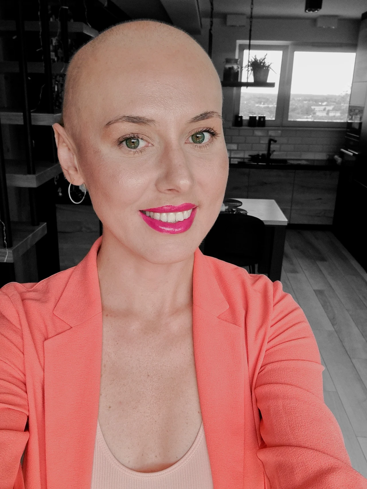 Przeszczep wątroby był dla Oli jedyną nadzieją. Leczenia podjęła się w Indiach Przeszczep wątroby był dla Oli jedyną nadzieją. Leczenia podjęła się w Indiach