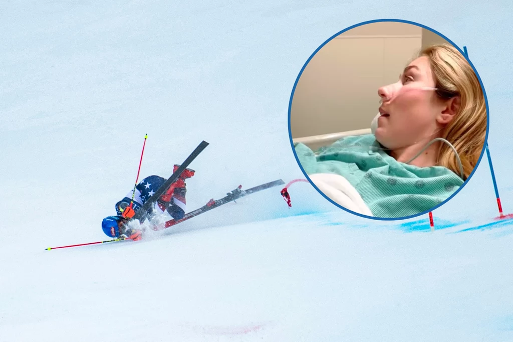 Mikaela Shiffrin przeszła kolejną operację po poważnym upadku Mikaela Shiffrin przeszła kolejną operację po poważnym upadku