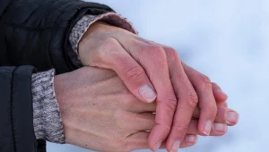 Podrażniona skóra na grzbietach dłoni to nie zawsze wina zimy. Czego to objaw?