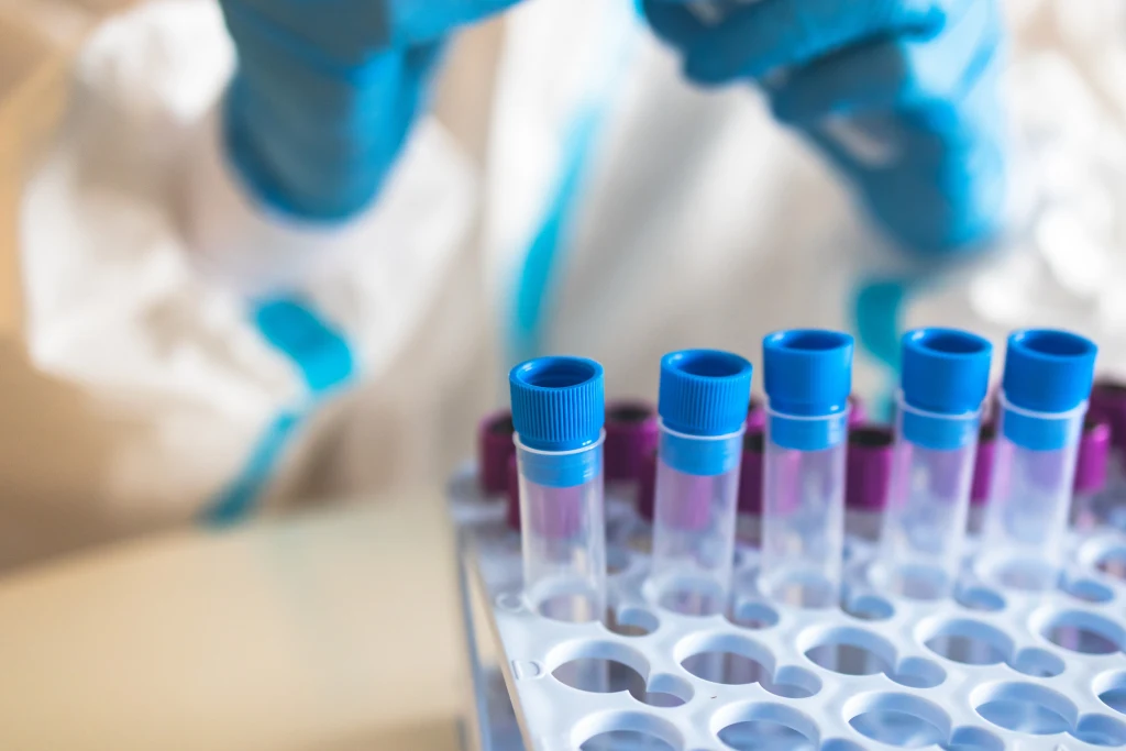 CRP powinno się utrzymywać u osób zdrowych na poziomie 0-5 mg/l