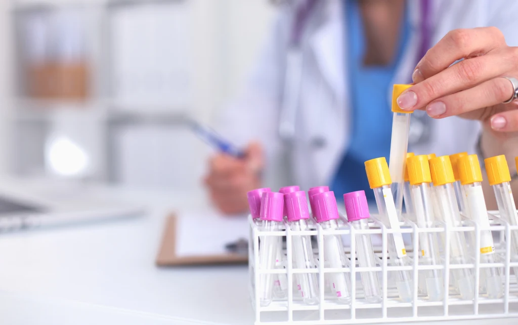 Wysoki poziom cholesterolu powoduje tworzenie się blaszek miażdżycowych w naczyniach tętniczych