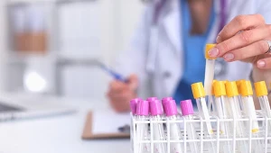 Wysoki poziom cholesterolu powoduje tworzenie się blaszek miażdżycowych w naczyniach tętniczych