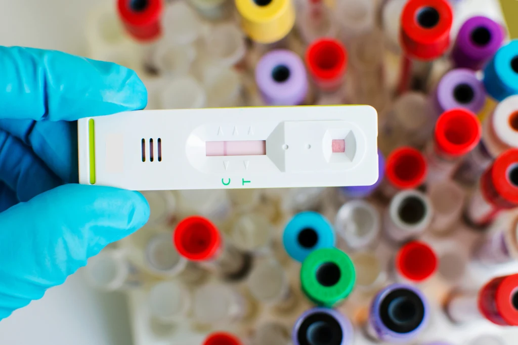 Czy domowe testy są wiarygodne? Żeby nie wyszły fałszywie, musi być widoczny jest pasek kontrolny