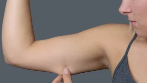 "Pelikany" to zmora wielu kobiet. Poświęć 5 minut dziennie, a pozbędziesz się ich w kilka tygodni