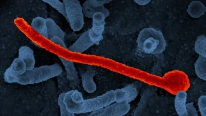 Wirus Ebola. Rośnie liczba wykrytych przypadków zakażenia w Ugandzie