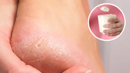 Wiedziałeś, że jogurt albo serek homogenizowany to świetne domowe sposoby na suche i szorstkie stopy?