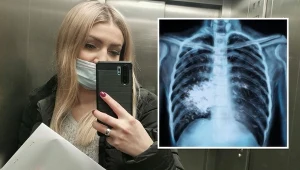 Dominika opowiada o swojej walce z chorobą