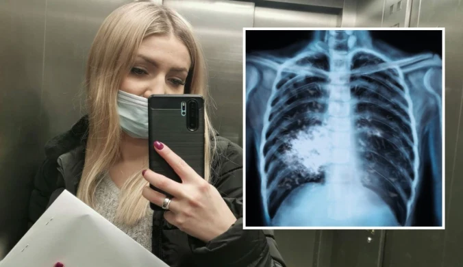 Dominika opowiada o swojej walce z chorobą