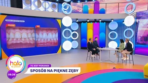 Jakub Rzeźniczak poddał się metamorfozie uśmiechu 