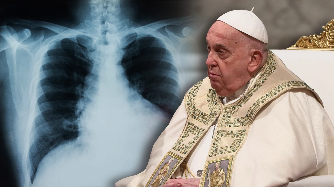 Papież Franciszek cierpi na obustronne zapalenie płuc Papież Franciszek cierpi na obustronne zapalenie płuc