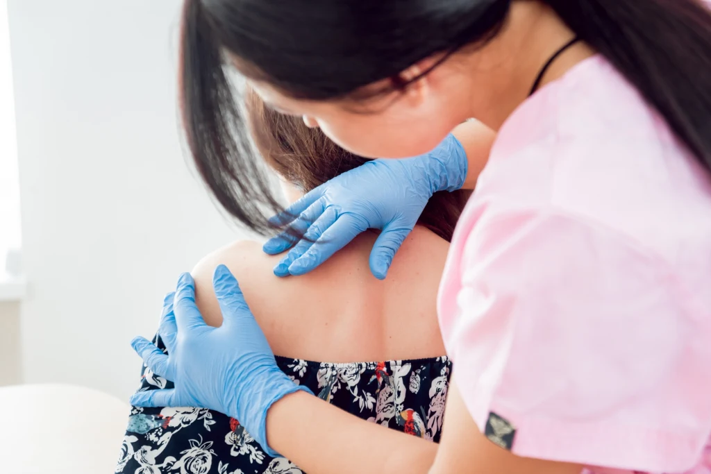 Z podejrzeniem łupieżu pstrego pacjent powinien zgłosić się do dermatologa Z podejrzeniem łupieżu pstrego pacjent powinien zgłosić się do dermatologa