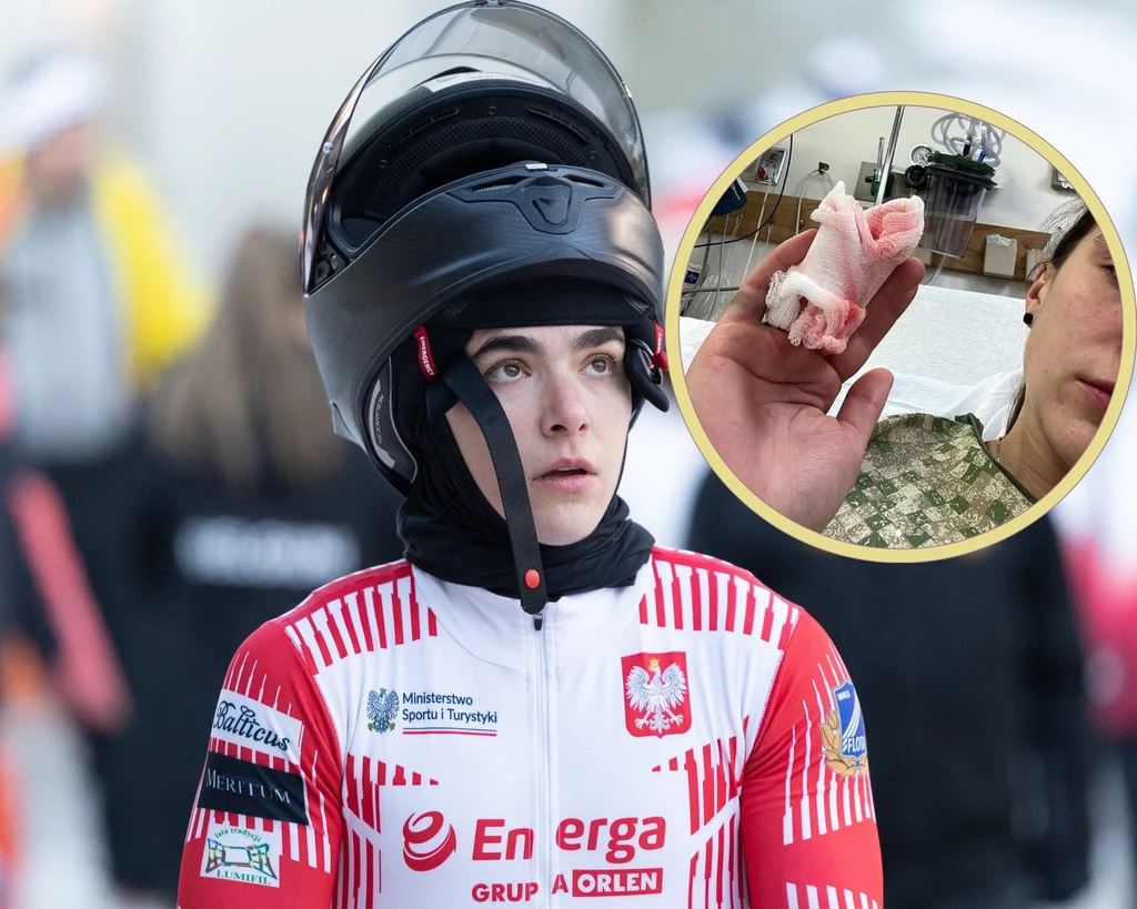 Linda Weiszewski i jej obcięty palec Linda Weiszewski i jej obcięty palec