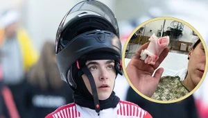 Linda Weiszewski i jej obcięty palec