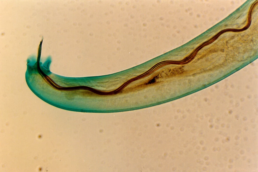 Nicień Angiostrongylus cantonensis