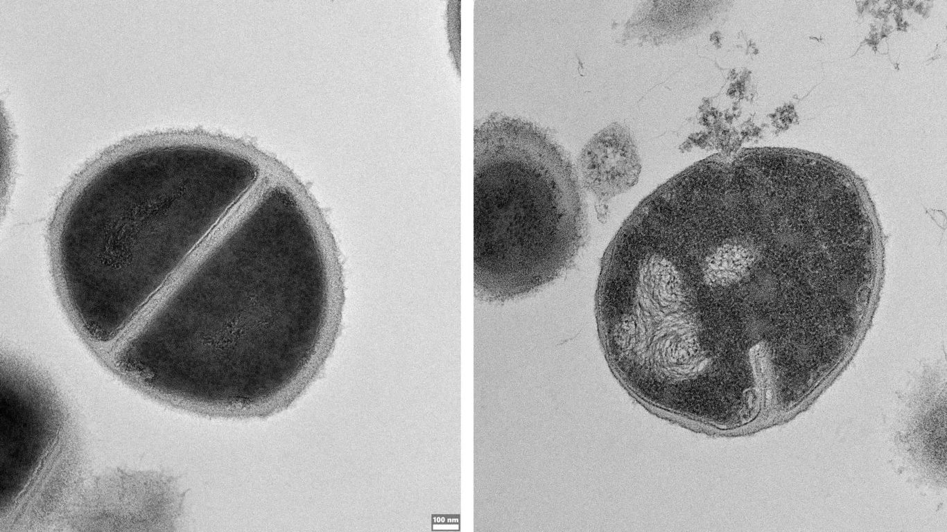 Bakterie Staphylococcus, zdrowa (po lewej) i rozrywana przez środki przeciwdrobnoustrojowe wytwarzane przez proteasom (po prawej)