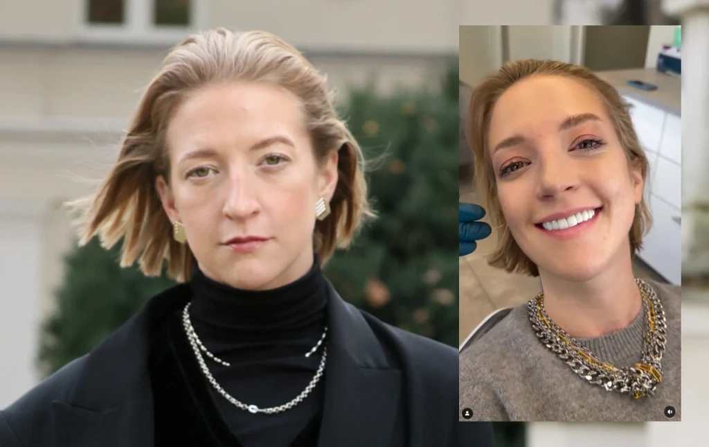 Lara Gessler zachwyciła nowym uśmiechem