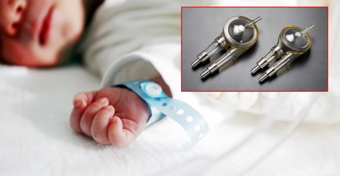 Ultranowoczesny system ReligaHeart PED to przełom w kardiochirurgii dziecięcej Ultranowoczesny system ReligaHeart PED to przełom w kardiochirurgii dziecięcej