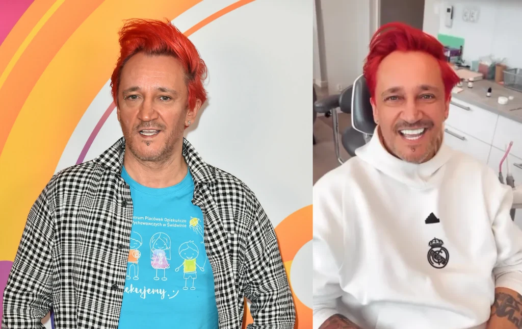 Michał Wiśniewski pozuje z nowym uśmiechem