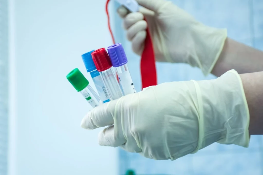 Badanie poziomu homocysteiny odbywa się przez pobranie próbki krwi żylnej i na badanie należy przyjść na czczo