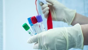 Taki wynik cholesterolu to sygnał alarmowy. Wprowadzono nowe normy