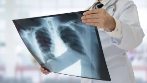 To największy na świecie zakaźny zabójca. 1,23 mln zgonów w 2024 r.