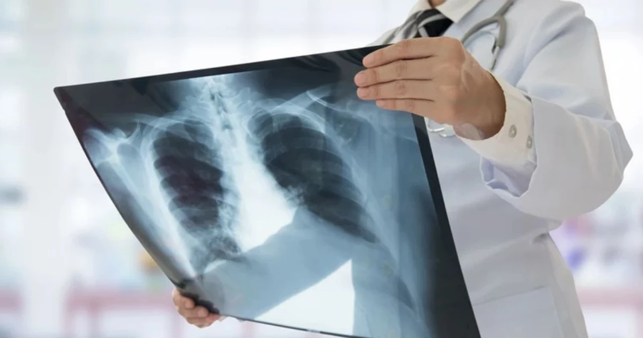 To największy na świecie zakaźny zabójca. 1,23 mln zgonów w 2024 r.