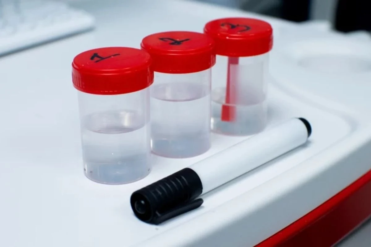 Badanie kału pozwala wykryć pasożyty, obecność bakterii, a także krwawienia w przewodzie pokarmowym