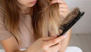 Niekoniecznie niedobór czy problemy z tarczycą. Dlatego tracisz tyle włosów