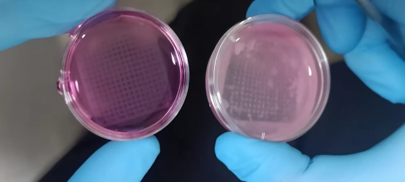 Struktura z ludzkimi keratynocytami wydrukowana w 3D