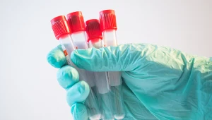 Pierwsze przypadki trądu od 44 lat. Objawy to nie tylko zmiany skórne