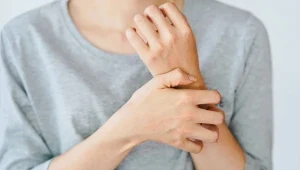 Skóra atopowa jest przesuszona, swędząca i skłonna do podrażnień oraz zakażeń