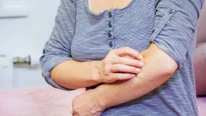 Jedz, a złagodzisz świąd i łuszczenie. Produkty zalecane są w chorobach skóry