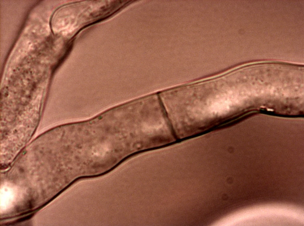 Naukowcy pod kątem wykorzystania w budownictwie badają m.in. grzyby Neurospora crassa Zbliżenie pod mikroskopem pokazujące strukturę komórkową, prawdopodobnie fragment grzybni lub podobnej biologicznej tkanki, z widocznymi przegrodami międzykomórkowymi.