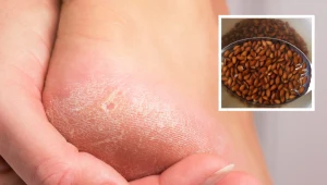 Nie ma lepszego sposobu na popękane pięty. Wymocz je w tym, a będą gładkie jak jedwab