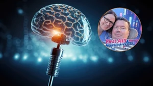 Pacjent z chipem Neuralink tworzy filmy na YouTube za pomocą myśli