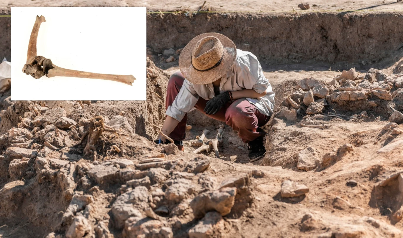 Widoczne złamanie kości udowej z przestawioną kością piszczelową, aby ukazać kąt nachylenia wynoszący 45 stopni Archeolog przy pracy na wykopaliskach, w pozycji klęczącej analizuje znaleziska w piasku. W górnym lewym rogu widoczna jest ilustracja przedstawiająca kość.